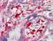 Non-SMC Condensin I Complex Subunit H antibody, orb19516, Biorbyt, Immunohistochemistry paraffin image 