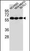 Cholinergic Receptor Nicotinic Alpha 10 Subunit antibody, PA5-48341, Invitrogen Antibodies, Western Blot image 
