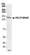 Proline, Glutamate And Leucine Rich Protein 1 antibody, NB200-331, Novus Biologicals, Western Blot image 