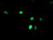 Zinc finger protein SNAI2 antibody, M01615-2, Boster Biological Technology, Immunofluorescence image 