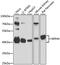 Endoplasmic Reticulum Protein 44 antibody, GTX66444, GeneTex, Western Blot image 