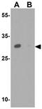 Uroplakin-1b antibody, GTX32032, GeneTex, Western Blot image 