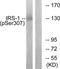 Insulin Receptor Substrate 1 antibody, TA312870, Origene, Western Blot image 