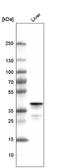 Ornithine Carbamoyltransferase antibody, AMAb91264, Atlas Antibodies, Western Blot image 