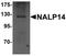 NLR Family Pyrin Domain Containing 14 antibody, TA320168, Origene, Western Blot image 