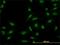 SMAD Family Member 5 antibody, H00004090-M03, Novus Biologicals, Immunocytochemistry image 