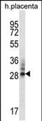 DnaJ Heat Shock Protein Family (Hsp40) Member C27 antibody, PA5-48442, Invitrogen Antibodies, Western Blot image 