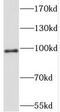 Stromal interaction molecule 2 antibody, FNab08322, FineTest, Western Blot image 