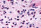 CD294 antibody, MBS243490, MyBioSource, Immunohistochemistry frozen image 