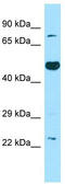 Thromboxane A Synthase 1 antibody, TA337958, Origene, Western Blot image 