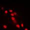 Spectrin Repeat Containing Nuclear Envelope Family Member 3 antibody, orb215388, Biorbyt, Immunofluorescence image 