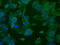 6-phosphofructo-2-kinase/fructose-2,6-biphosphatase 4 antibody, M07028, Boster Biological Technology, Immunofluorescence image 