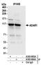 Double-stranded RNA-specific adenosine deaminase antibody, A303-884A, Bethyl Labs, Immunoprecipitation image 
