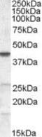Abhydrolase Domain Containing 5 antibody, PA5-18666, Invitrogen Antibodies, Western Blot image 