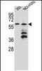 PRAME Family Member 12 antibody, PA5-71634, Invitrogen Antibodies, Western Blot image 