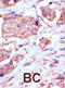 Ephrin type-B receptor 6 antibody, abx033539, Abbexa, Immunohistochemistry paraffin image 