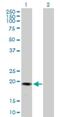 Gremlin 2, DAN Family BMP Antagonist antibody, H00064388-B01P, Novus Biologicals, Western Blot image 