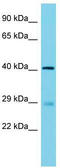 Visual System Homeobox 1 antibody, TA329971, Origene, Western Blot image 