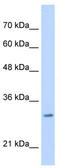 Myeloid leukemia factor 2 antibody, TA339010, Origene, Western Blot image 