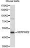Serpin Family E Member 2 antibody, LS-C749542, Lifespan Biosciences, Western Blot image 