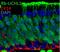 Ubiquitin C-Terminal Hydrolase L1 antibody, 14730-1-AP, Proteintech Group, Immunofluorescence image 