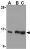 Ubiquitin Conjugating Enzyme E2 N antibody, NBP1-76593, Novus Biologicals, Western Blot image 