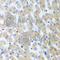 Protein arginine N-methyltransferase 2 antibody, A5835, ABclonal Technology, Immunohistochemistry paraffin image 