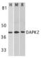 Death Associated Protein Kinase 2 antibody, TA306051, Origene, Western Blot image 