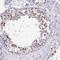 Anillin antibody, NBP2-38630, Novus Biologicals, Immunohistochemistry frozen image 