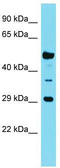 Olfactory Receptor Family 6 Subfamily Q Member 1 (Gene/Pseudogene) antibody, TA334813, Origene, Western Blot image 