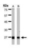 Hydroxysteroid 17-Beta Dehydrogenase 10 antibody, PA5-27155, Invitrogen Antibodies, Western Blot image 