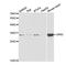 Growth Factor Receptor Bound Protein 2 antibody, TA332843, Origene, Western Blot image 