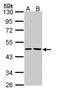 Epoxide Hydrolase 1 antibody, TA308517, Origene, Western Blot image 