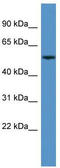 Cytochrome P450 Family 3 Subfamily A Member 5 antibody, TA342855, Origene, Western Blot image 