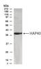 Coagulation Factor VIII Associated 3 antibody, PA1-31439, Invitrogen Antibodies, Western Blot image 
