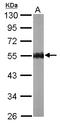 Protein Kinase AMP-Activated Non-Catalytic Subunit Gamma 2 antibody, LS-C186349, Lifespan Biosciences, Western Blot image 