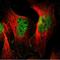 Protein Tyrosine Phosphatase Receptor Type J antibody, NBP1-86547, Novus Biologicals, Immunofluorescence image 