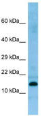 Salivary acidic proline-rich phosphoprotein 1/2 antibody, TA338169, Origene, Western Blot image 