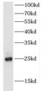 FEV Transcription Factor, ETS Family Member antibody, FNab03083, FineTest, Western Blot image 