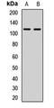Semaphorin-4C antibody, LS-C668299, Lifespan Biosciences, Western Blot image 