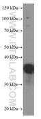 Eukaryotic Translation Elongation Factor 1 Delta antibody, 60085-1-Ig, Proteintech Group, Western Blot image 