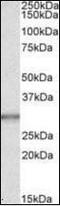 CA1 antibody, orb89327, Biorbyt, Western Blot image 