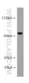 DNA Topoisomerase I antibody, 20705-1-AP, Proteintech Group, Western Blot image 