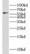 KIAA0895 antibody, FNab04537, FineTest, Western Blot image 