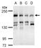 ERCC Excision Repair 6, Chromatin Remodeling Factor antibody, TA307948, Origene, Western Blot image 