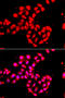 Calcium/Calmodulin Dependent Protein Kinase ID antibody, 14-989, ProSci, Immunofluorescence image 
