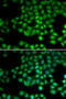 Transient Receptor Potential Cation Channel Subfamily M Member 2 antibody, abx004694, Abbexa, Western Blot image 