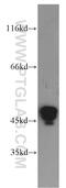 Keratin 20 antibody, 17329-1-AP, Proteintech Group, Western Blot image 