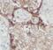 Solute Carrier Family 2 Member 1 antibody, FNab03500, FineTest, Immunohistochemistry frozen image 
