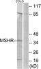 Melanocyte-stimulating hormone receptor antibody, A30842, Boster Biological Technology, Western Blot image 
